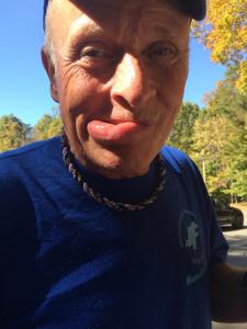 Gary Knipling and his bee-inflicted lip "boo boo"