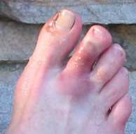 A Toe After Catoctin